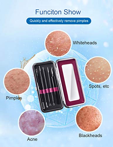 5 komada mitesera pinceta acne extractor, Komplet alata za uklanjanje mitesera, alat za uklanjanje akni sa kožnom