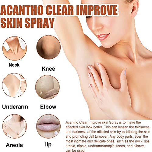 Acantho Clear Therapy Sprej, Sprej Za Terapiju Acanthosis Nigricans-A01