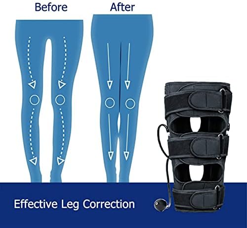 Yanfly o / x remen za korekciju nogu, kaiš za korekciju potpore beda, kucni konac za deformitet koljena