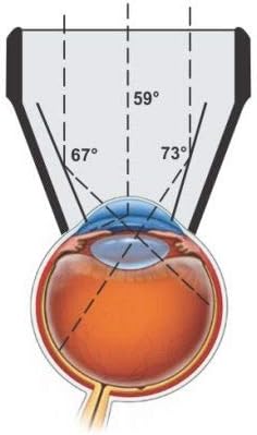 OPTICLEAR jedno ogledalo Goniolens za gledanje ugao prednje komore i Centralne & periferne retine