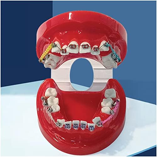 KH66ZKY TIPODONTS Ortodoncija demonstracijski model - ortodontski model korekcije malokluzije - za decu za odrasle zubno učenje